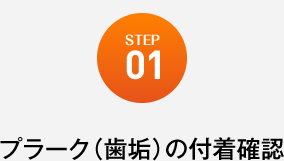 プラーク（歯垢）の付着確認