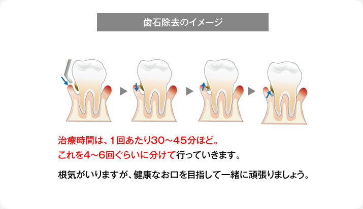 根気がいりますが、健康なお口を目指して一緒に頑張りましょう