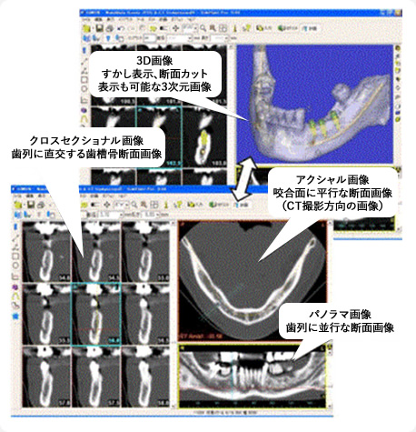 CT検査の必要性について