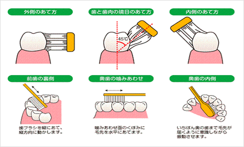 歯ブラシの当て方