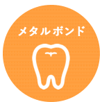 メタルボンド